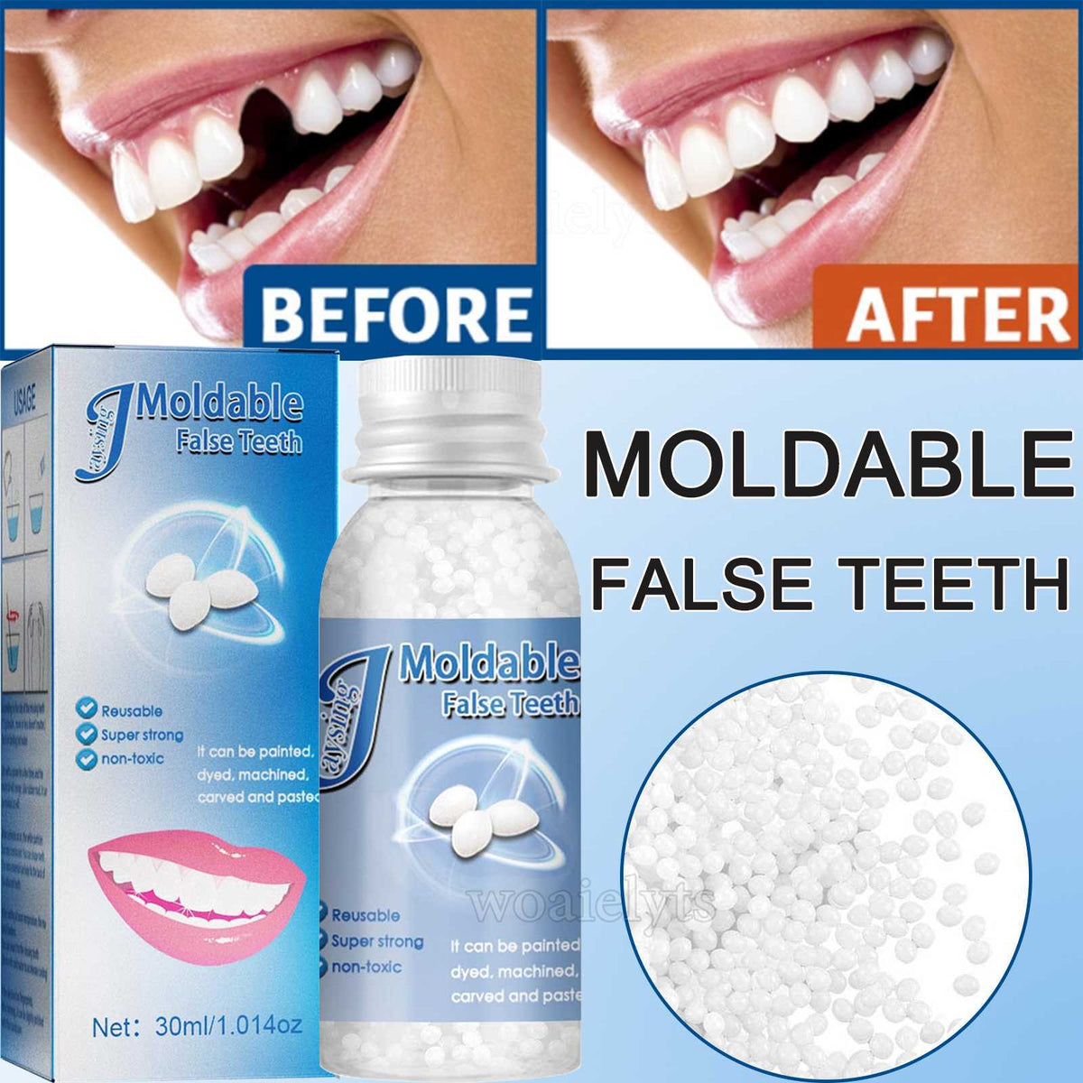 Teeth Repair Kit - Temporary Tooth Replacement & Gaps Filler
