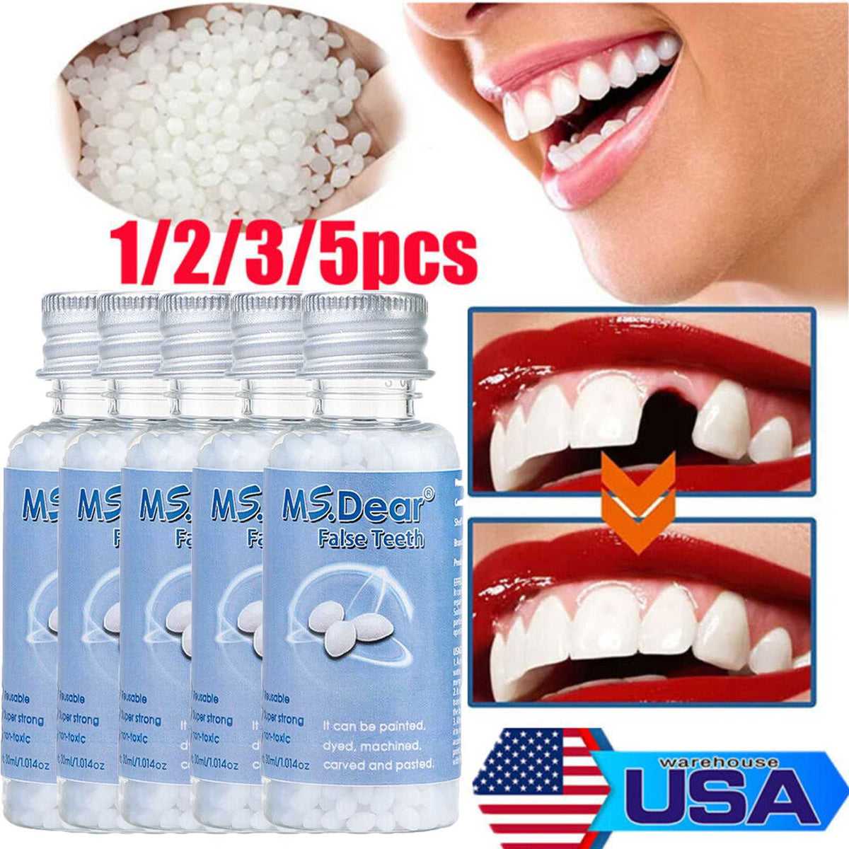 Temporary Tooth Repair Beads Moldable Filler for Broken Teeth Gaps - Reusable