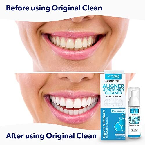 AlignerCleaning Foam for Invisalign & Clear Aligners - Assorted Sizes
