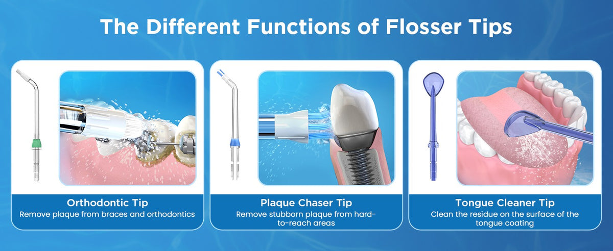 Waterpik Replacement Tips Set - 6 Color-Coded Water Flosser Heads
