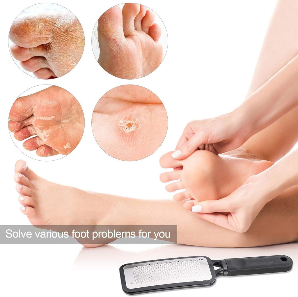 Pedicure Foot Rasp File Callus Remover Dead Skin Scrubber for Feet Black