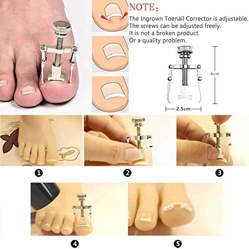 Professional 12-Piece Toenail Care Kit for Ingrown Nails and Pedicure