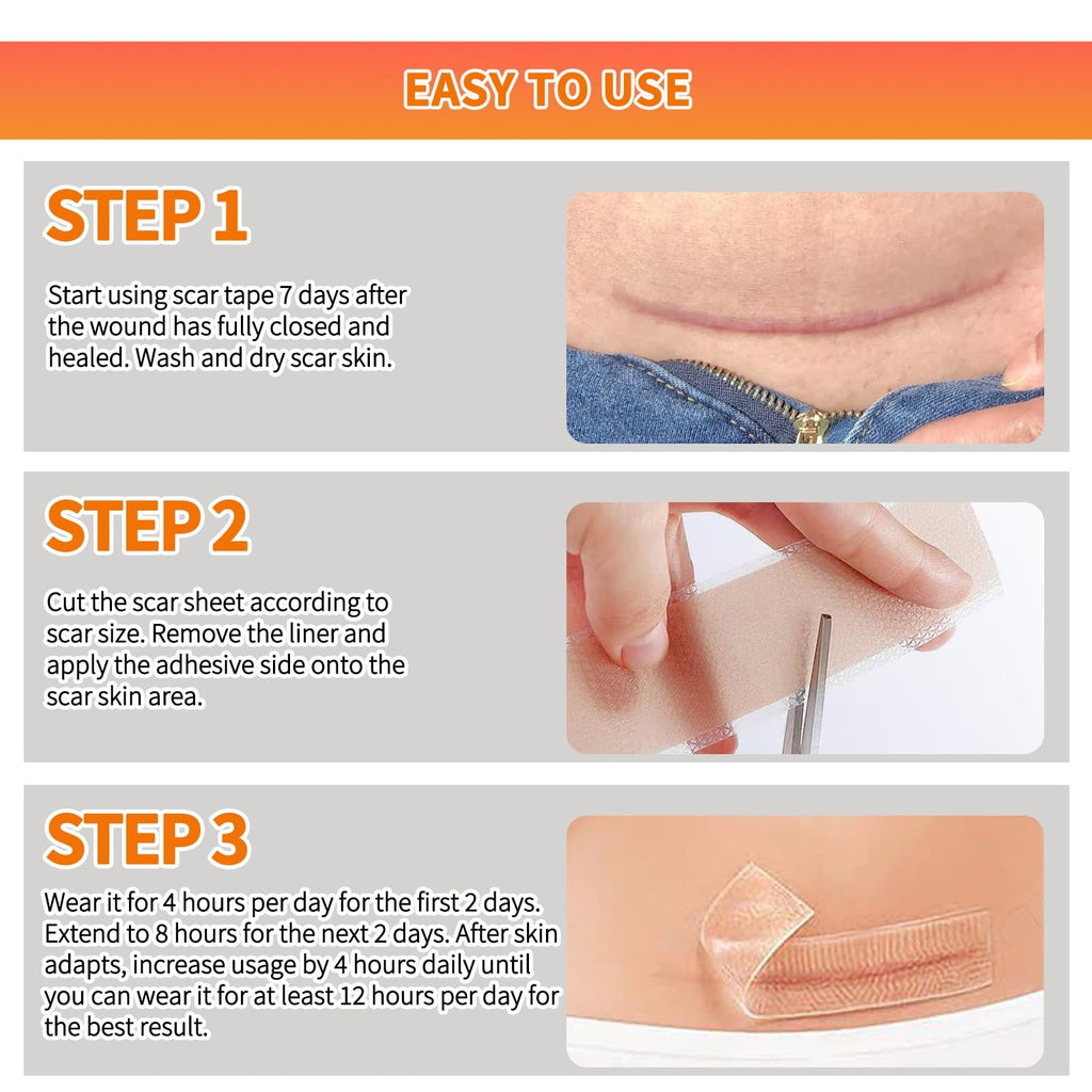 Silicone Scar Sheets Roll 1.6x60 Inches Medical Tape for Scar Removal