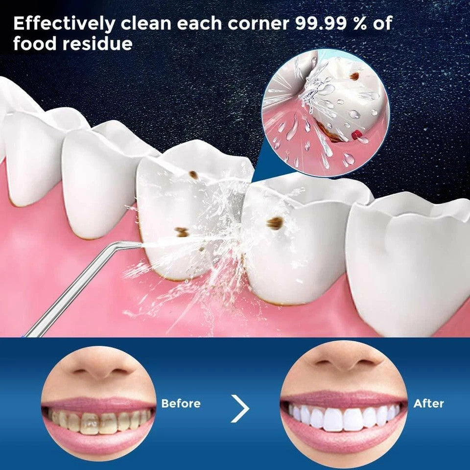 380ML Cordless Water Flosser Oral Irrigator Teeth Cleaner with 4 Tips