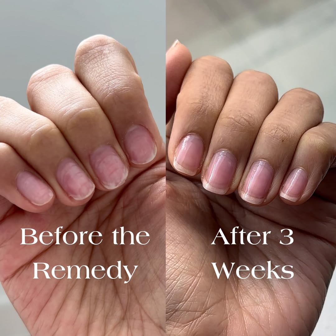 Nail Strengthening Polish for Damaged, Brittle Nails - Tinted Repair & Growth