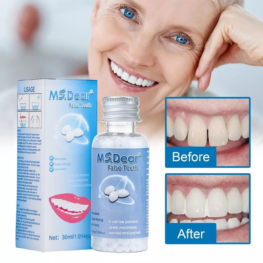 Teeth Repair Beads for Loose Tooth Fixing - Temporary Dental Moldable Resin
