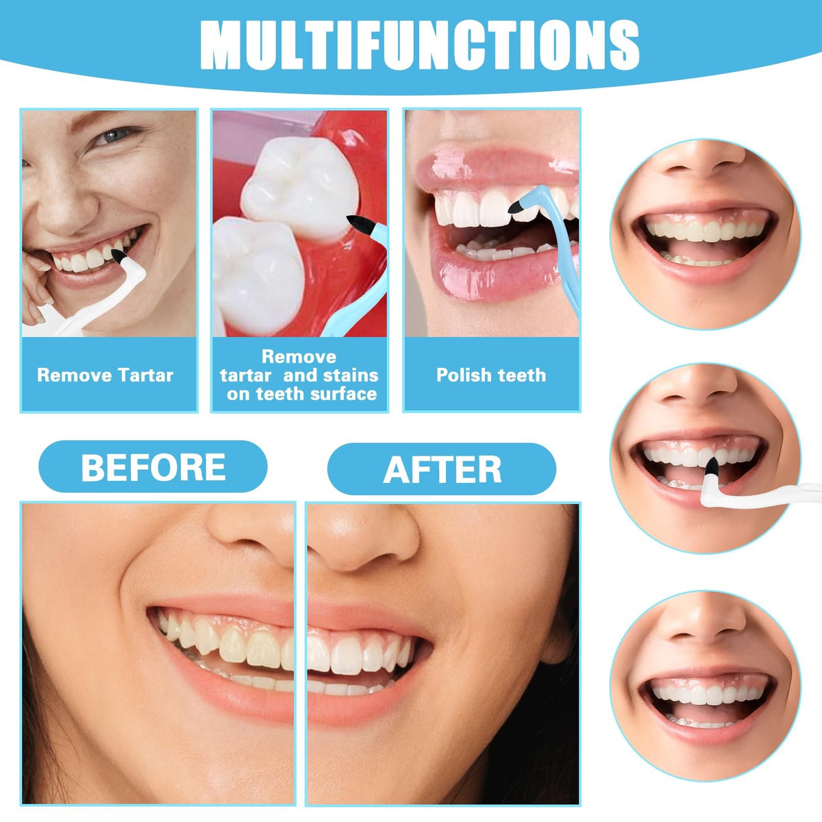8-Piece Dental Tartar and Plaque Removal Kit for Teeth Cleaning
