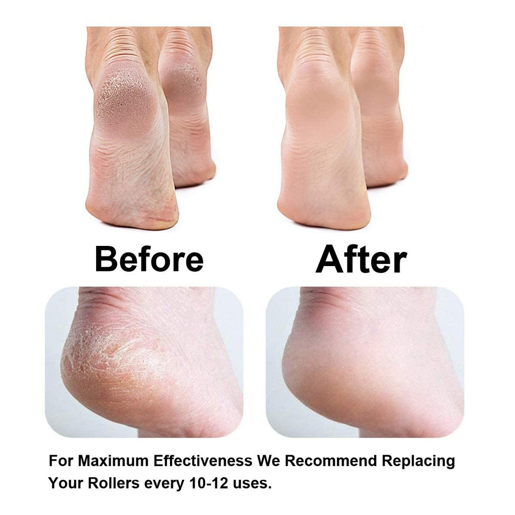 Replacement Roller for Callus Remover - Extra Coarse Black Grit 6 Pack
