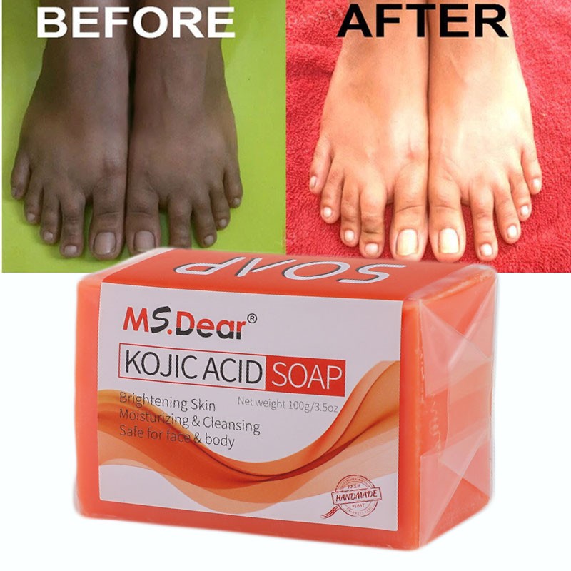 Acid Soap Dark Skin Whitening Lightening Face & Body 100g - Brightening & Cleansing