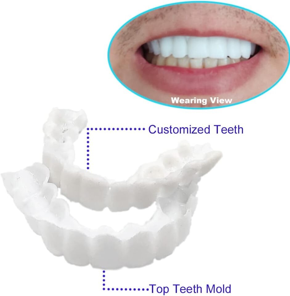 Instant Fake Teeth Smile Set - 2 Upper Dentures for Temporary Confidence