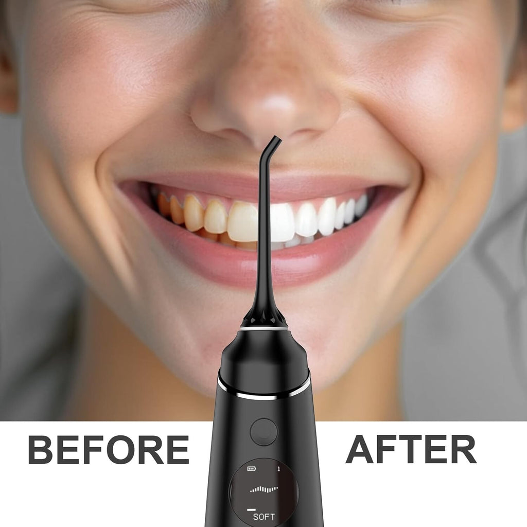Cordless Water Flosser Dental Irrigator with 4 Modes 280ML Rechargeable