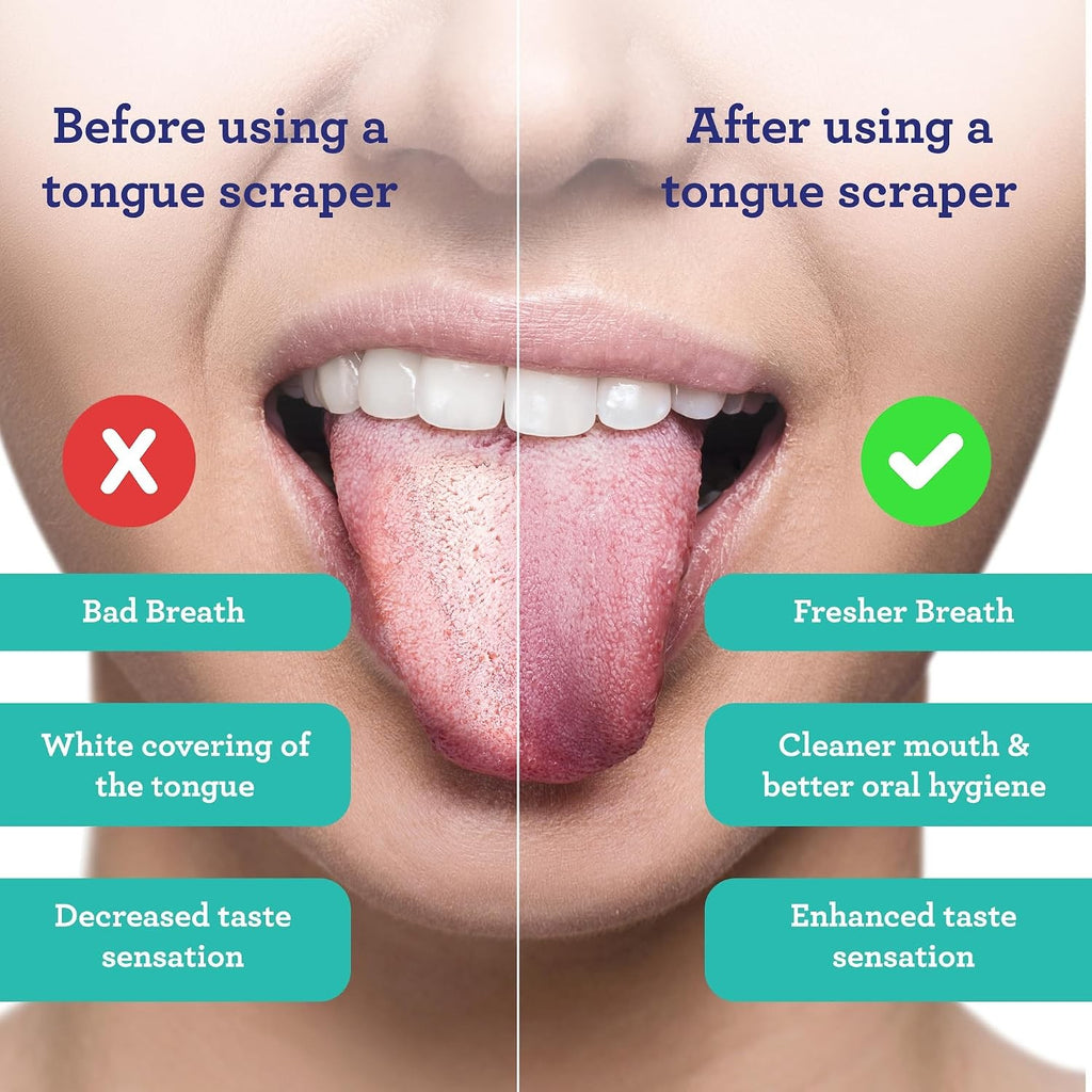 Stainless Steel Tongue Scraper with Travel Case - Adults & Kids, 2 Pack