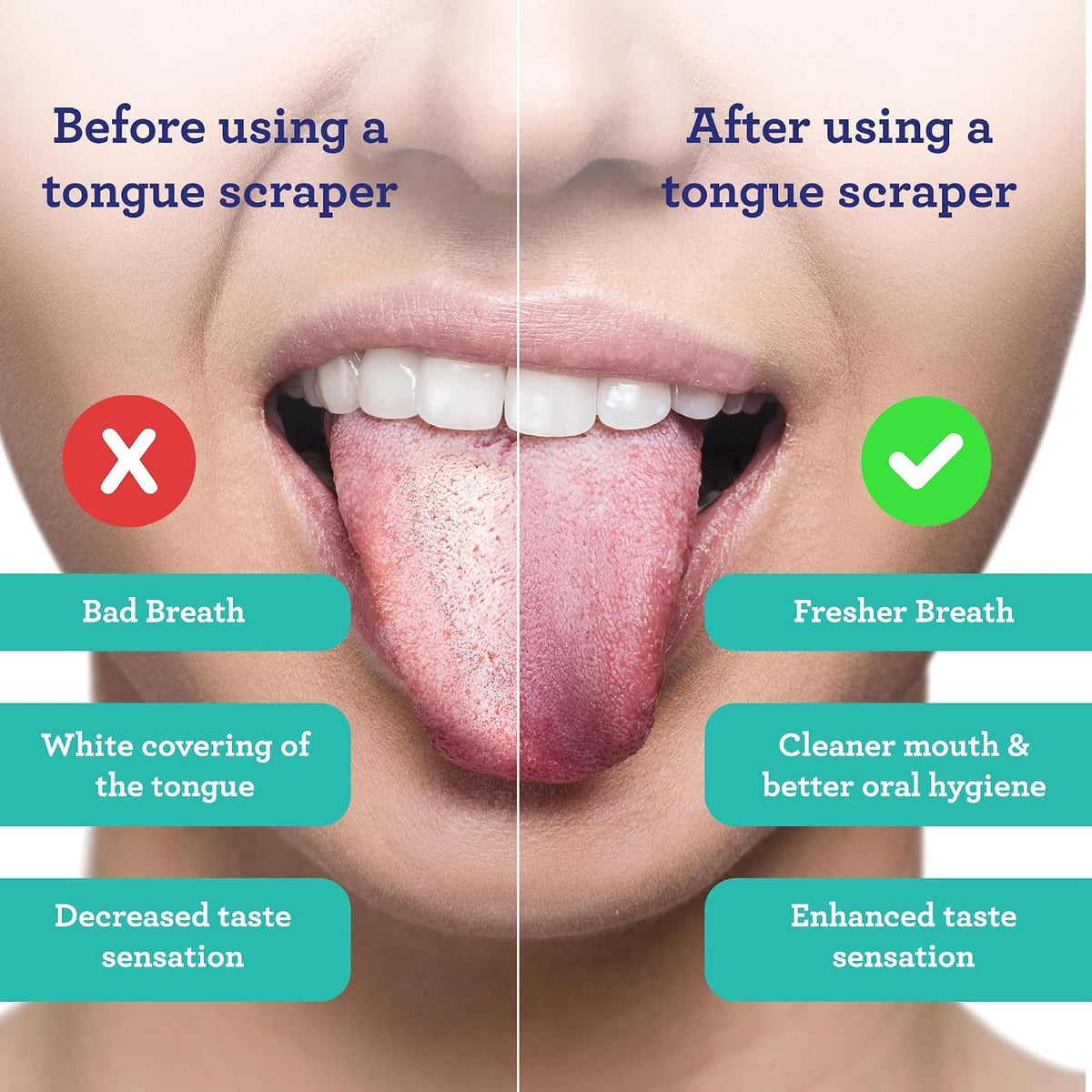 Stainless Steel Tongue Scraper with Travel Case - Adults & Kids, 2 Pack