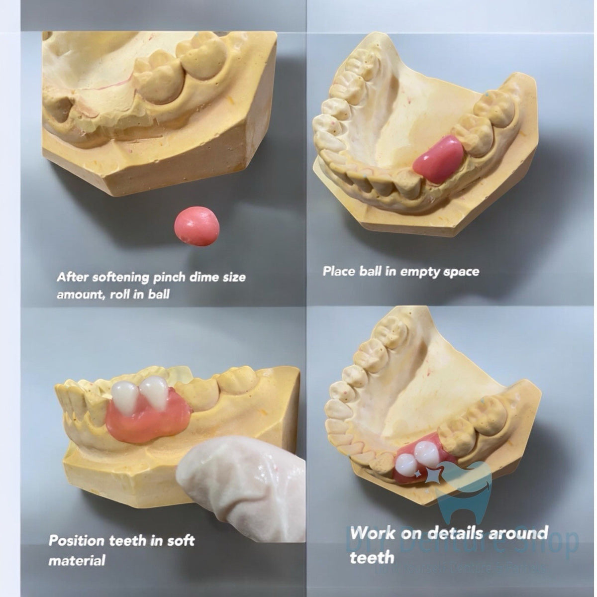 DIY Denture Kit Complete Set for Custom Temporary Teeth - Full or Partial