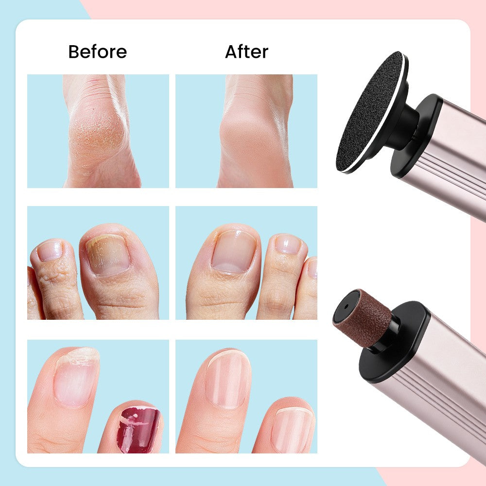 Electric Callus Remover Foot Sander Pedicure Tool with 9 Speeds & LCD Display