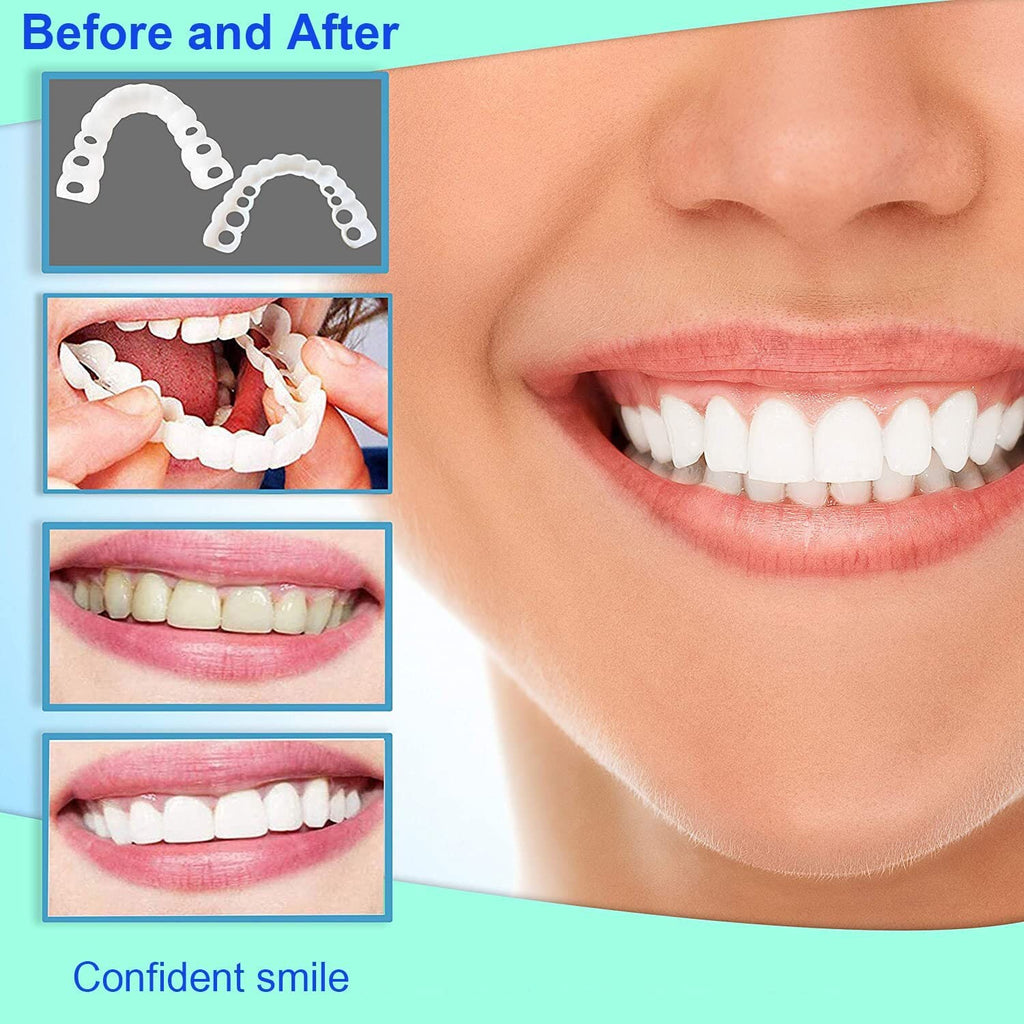 Snap-On Upper and Lower Dental Veneers Set - Reusable Teeth Cover for Adults