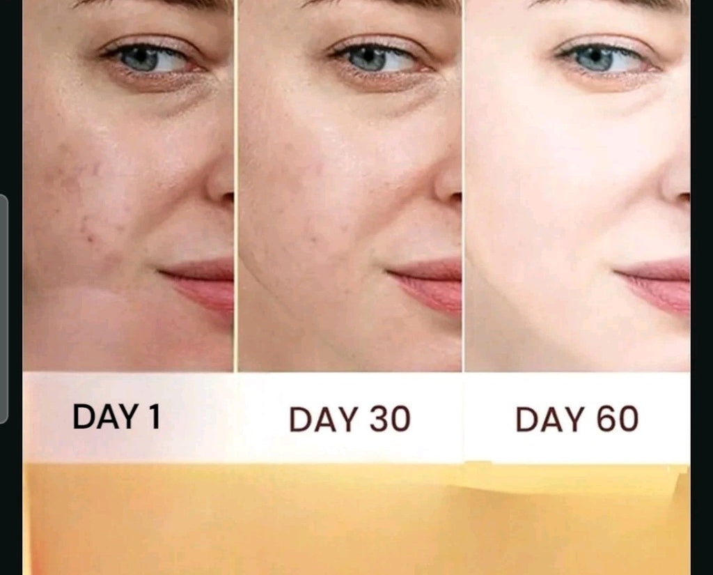 Oil Control Sunscreen SPF 50+ for Sensitive & Oily Skin - Matte Finish, Water Resistant