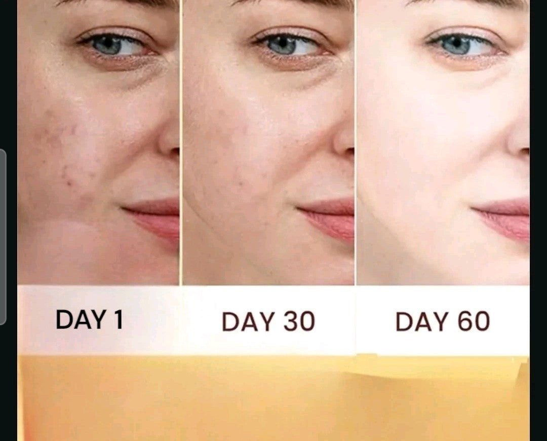 Oil Control Sunscreen SPF 50+ for Sensitive & Oily Skin - Matte Finish, Water Resistant
