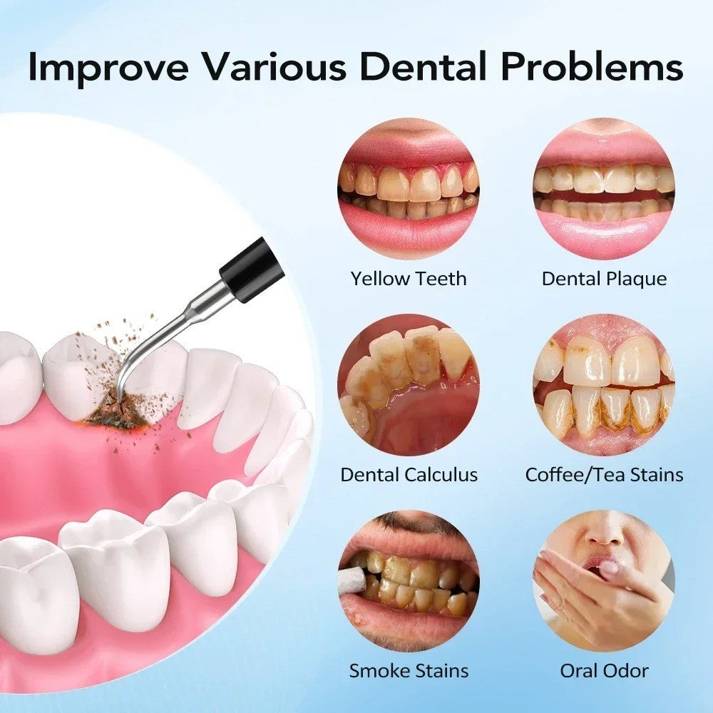 Electric Dental Scaler with 5 Modes, LED Light & USB Rechargeable