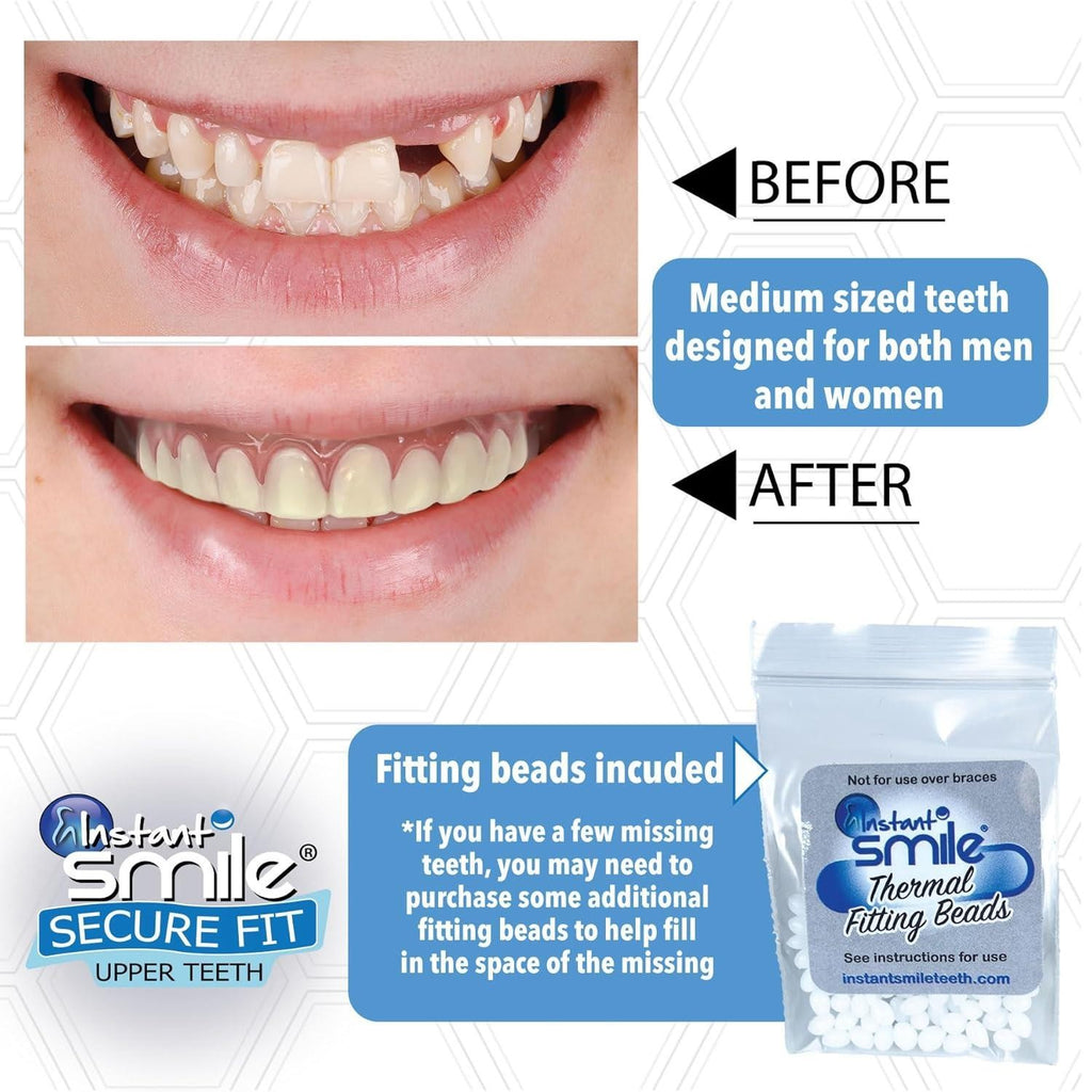 Instant Smile Upper Teeth Veneer - Natural Shade, Reusable Fit Over Existing Teeth