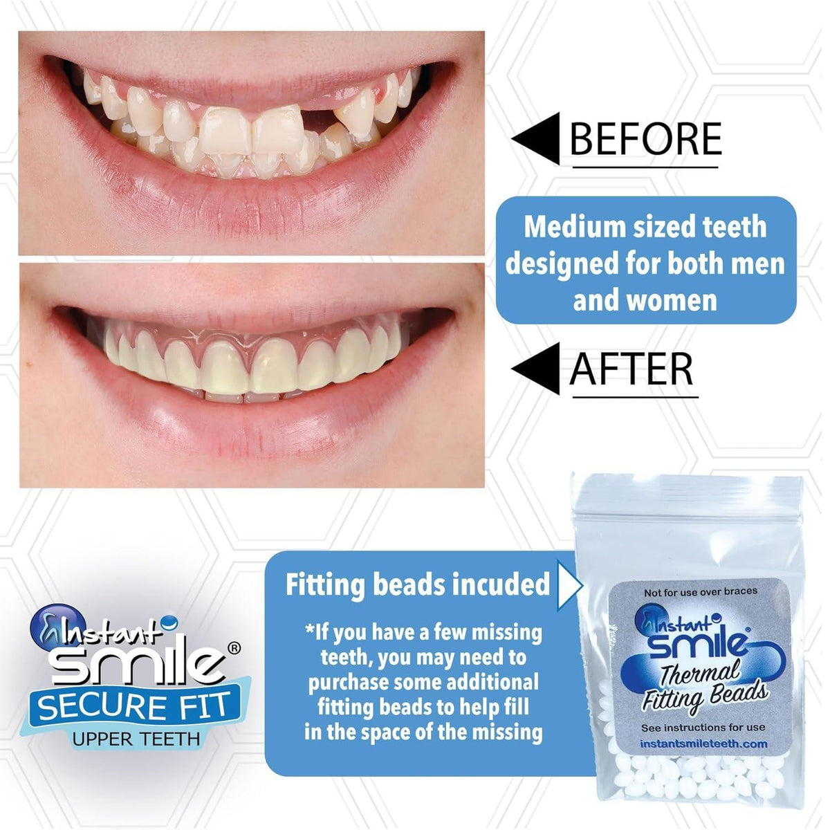 Instant Smile Upper Teeth Veneer - Natural Shade, Reusable Fit Over Existing Teeth