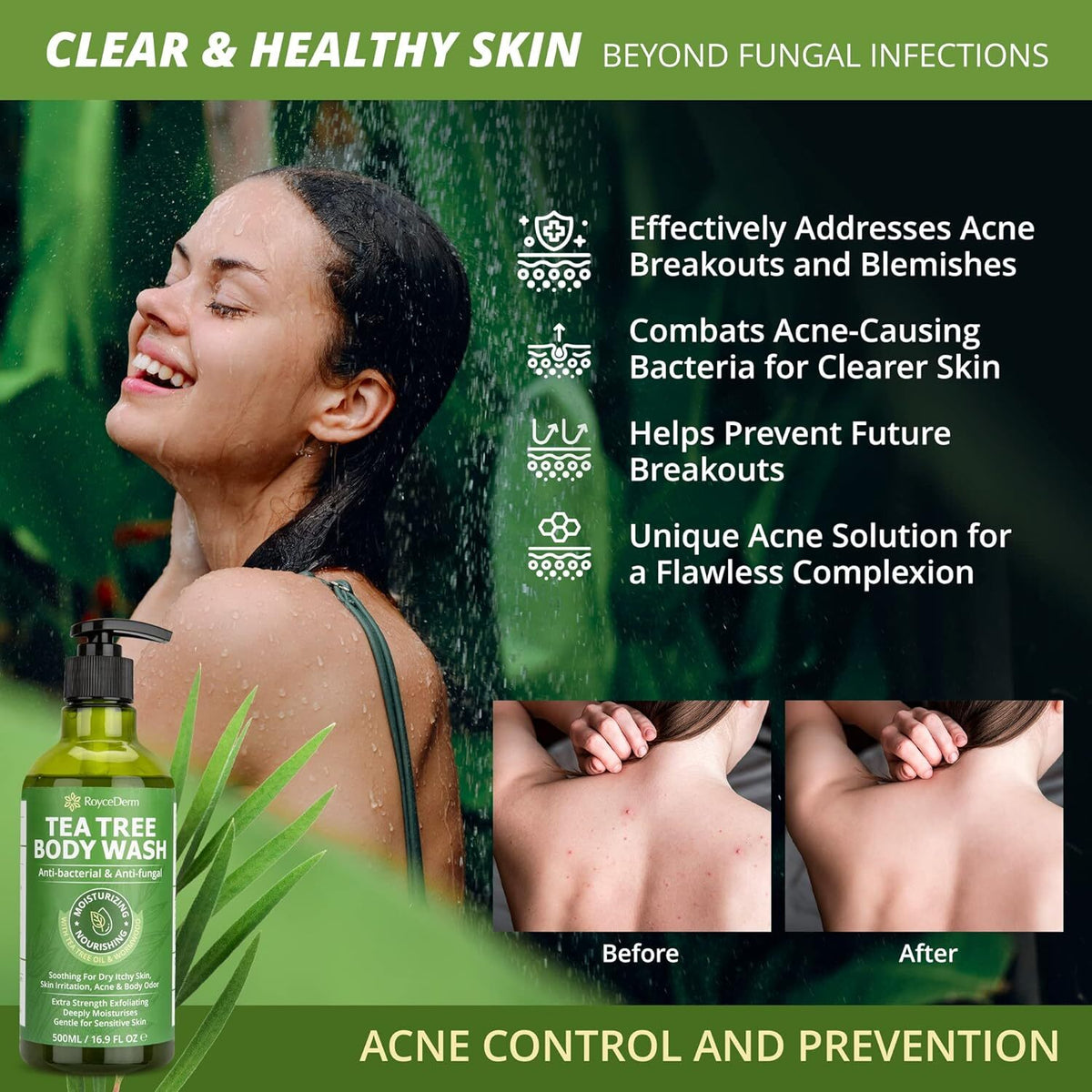 Antifungal Body Wash & Soap with Tea Tree Oil – Natural Antibacterial Cleansing for Fungal Infections