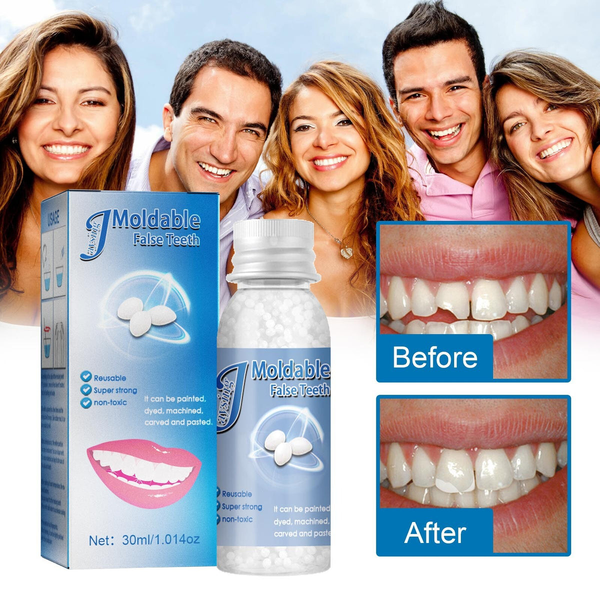Resin False Teeth Gap Filler & Tooth Repair Moldable Adhesive - Safe & Reusable