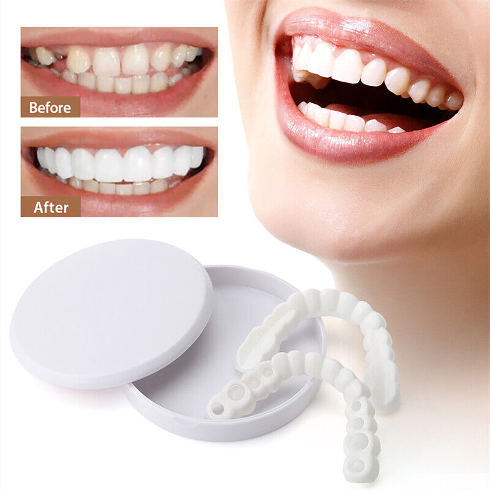 Snap-On Upper and Lower Dental Veneers Set - Reusable Teeth Cover for Adults