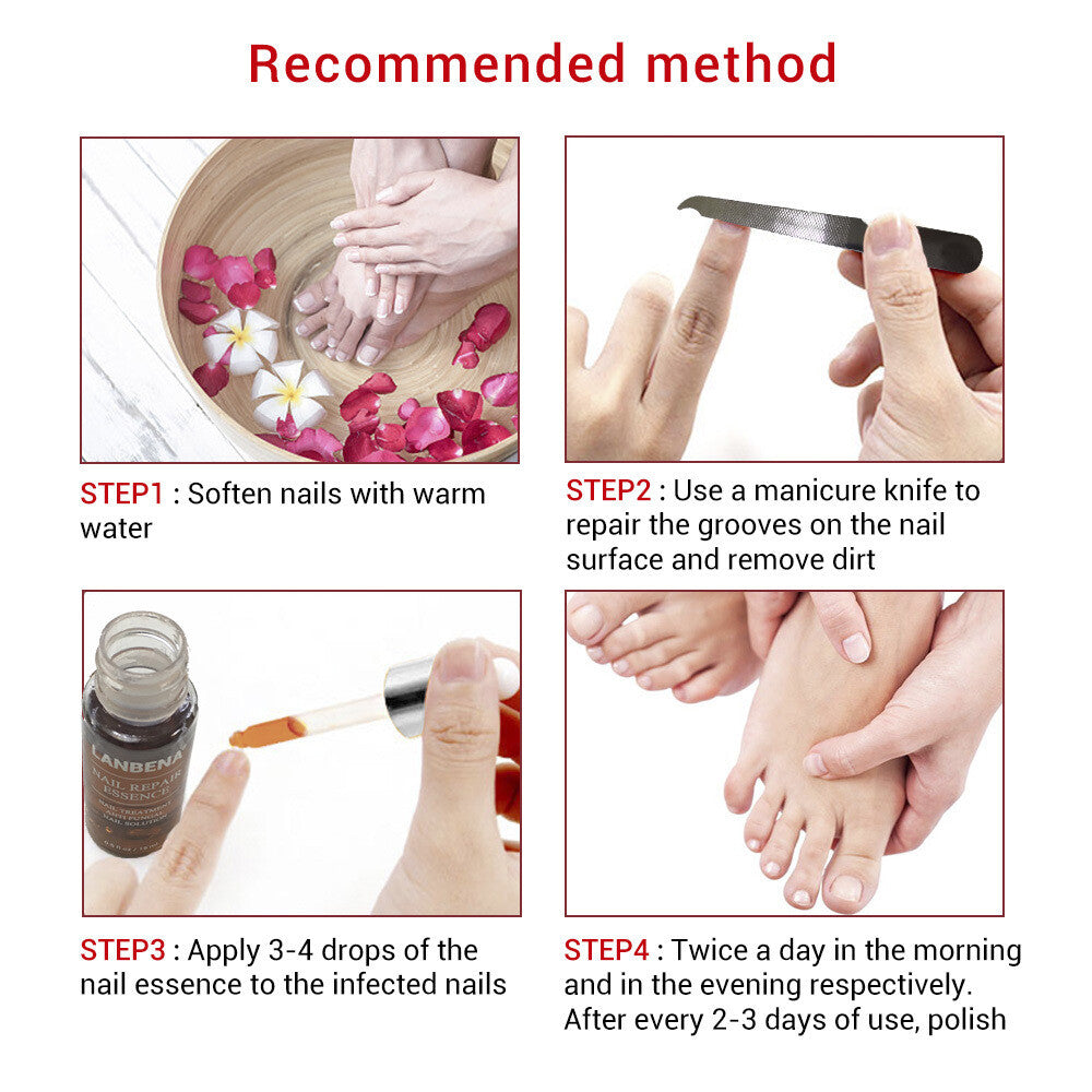 Ginger Antibacterial Nail Treatment Serum for Fungal Repair - 2PCS
