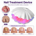 Nail Fungus Laser Treatment Device for Toenail & Fingernail Care