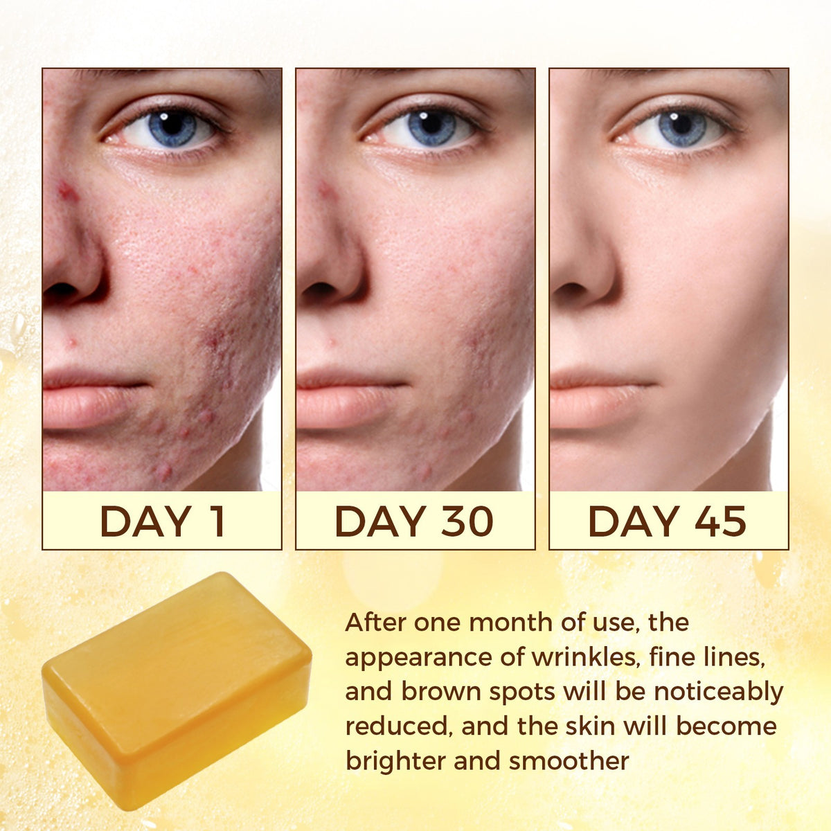 Turmeric Kojic Acid Soap for Skin Brightening & Dark Spot Removal 115g