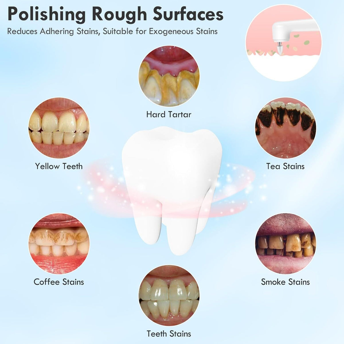 Electric Tooth Polisher for Daily Cleaning & Whitening - Rechargeable USB, 5 Speed Modes, 5 Brush Heads