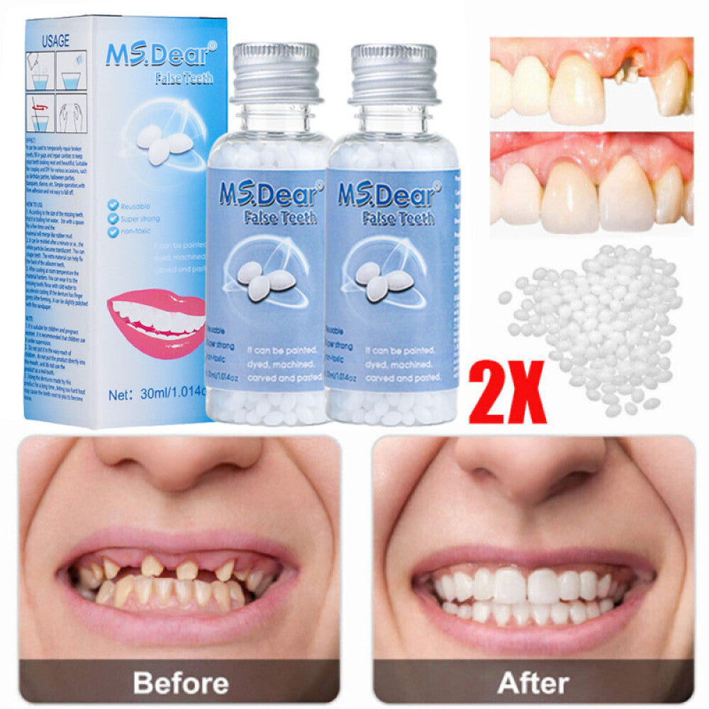 Teeth Repair Kit - Temporary Dental Filling & Missing Tooth Replacement