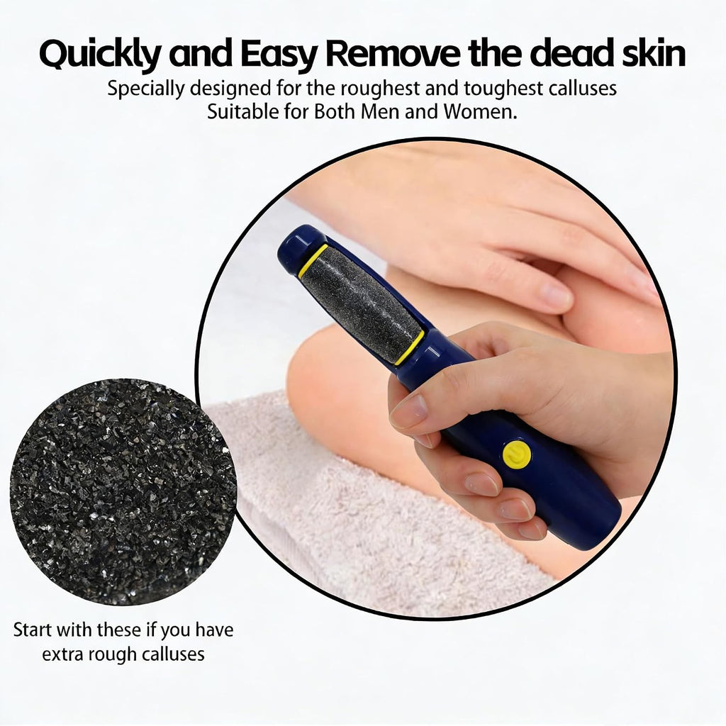 Replacement Rollers for Foot Files - 12 Extra Coarse Micro-Diamond Abrasive Pads