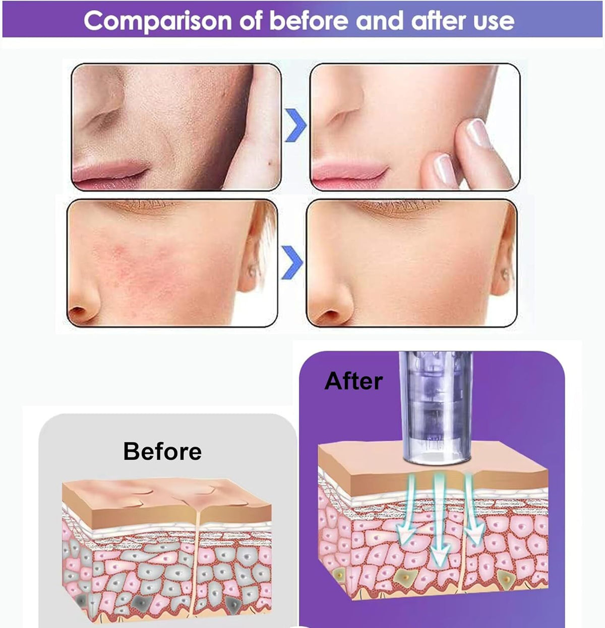 Electric Facial Skin Care Pen for Wrinkle Removal - Portable Anti-Aging Device