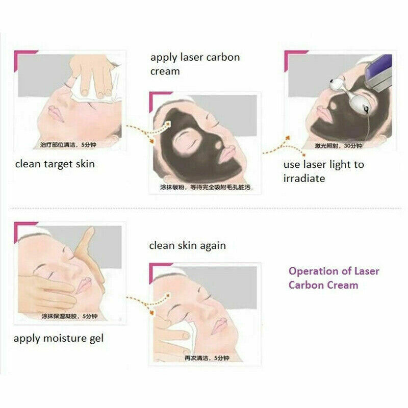 Carbon Gel for Laser Skin Rejuvenation - 3 Pack for Nd YAG Facial Treatments