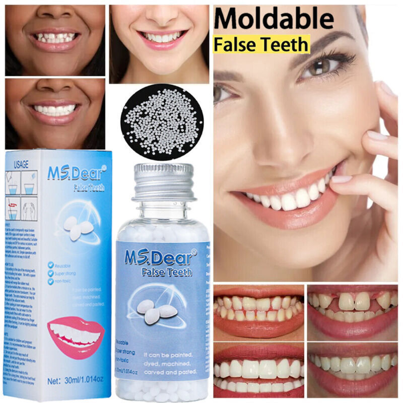 Teeth Repair Kit Moldable False Tooth Beads Reusable Temporary Fix