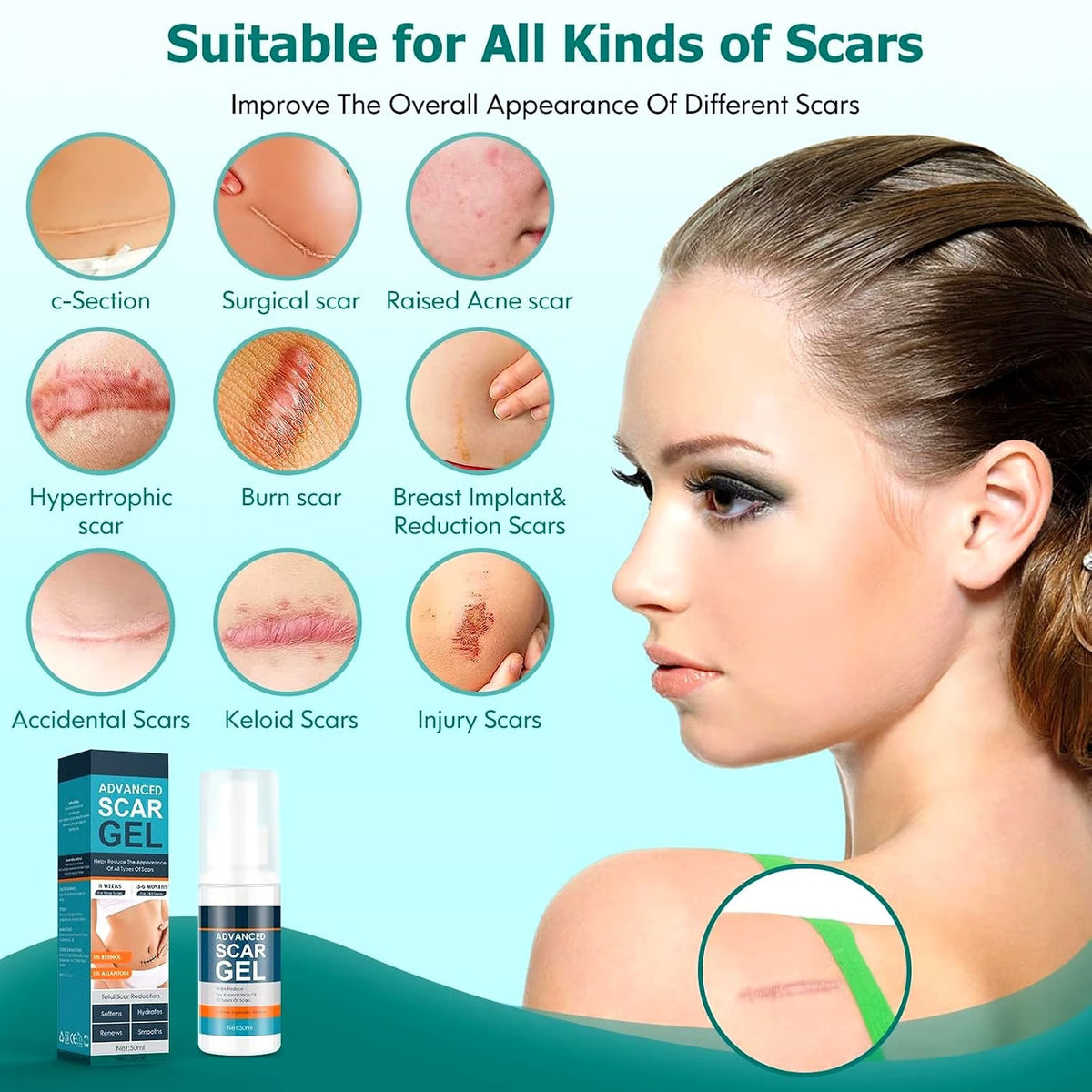 Silicone Scar Gel Cream for Face & Body - 1.76oz Scar & Burn Treatment