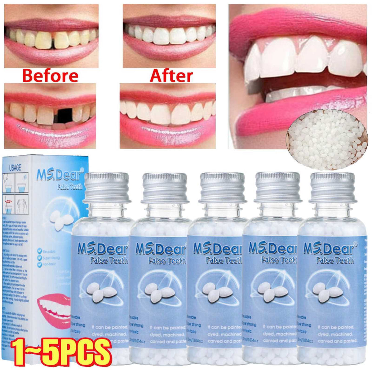 Teeth Repair Kit - Temporary Missing & Broken Tooth Replacement Set - Multiple Quantities