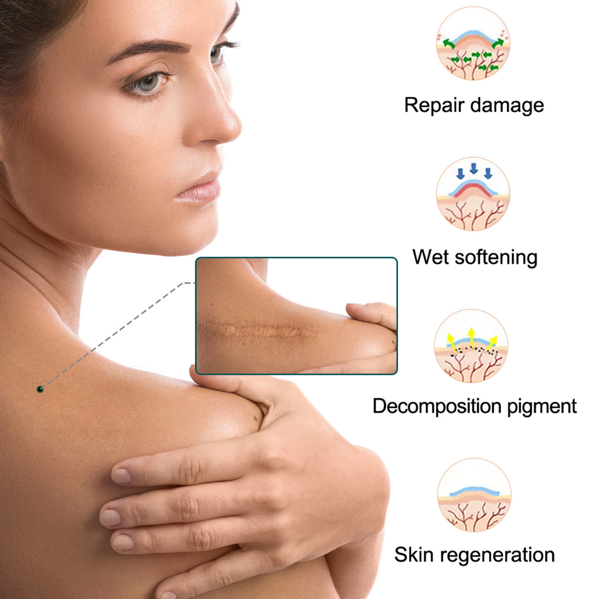 Silicone Scar Removal Tape for Hypertrophic & Keloid Scars - 1.6" x 60-150"