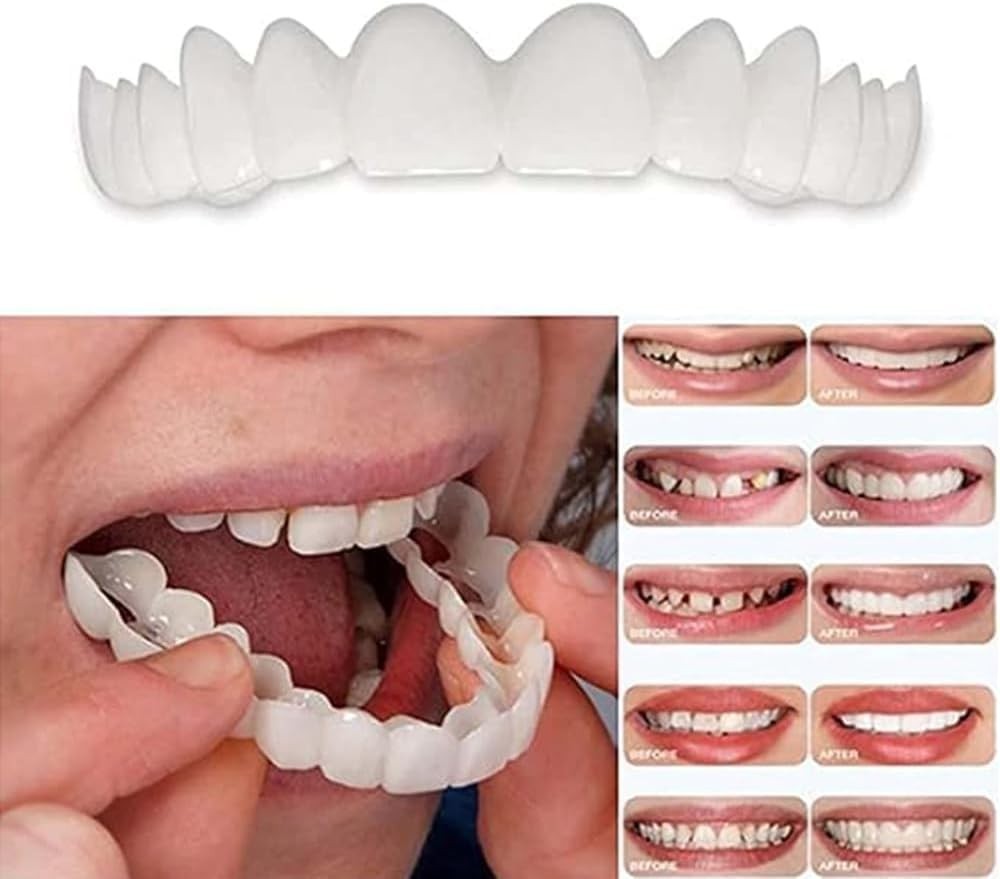 Temporary Dental Veneers Kit - Instant Smile Makeover for Men & Women