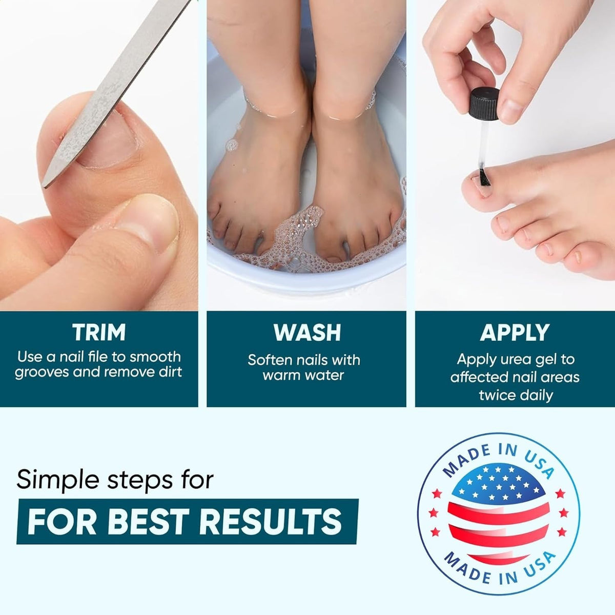 Urea 50% Nail Gel for Thick Toenails & Calluses - Softens, Exfoliates, Quick-Dry, 1 fl oz