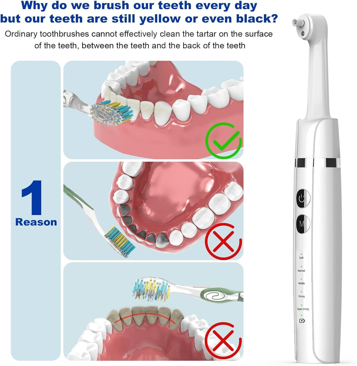 Professional Teeth Polishing Kit with USB Charging, 5 Speeds & Whitening Paste