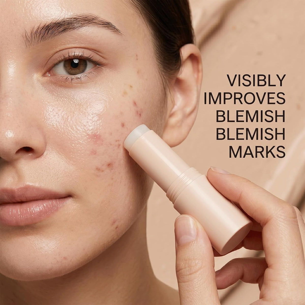 Silicone Scar Stick for Old & New Scars - Acne & Stretch Mark Treatment