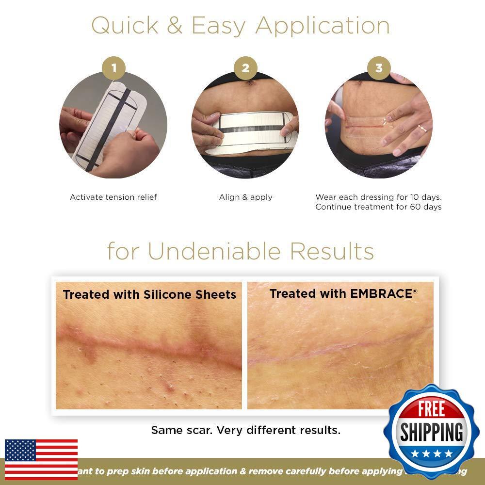 Medical Silicone Scar Sheets for New Hypertrophic & Keloid Scars - 6.3 Inch Extra-Large 30-Day Supply