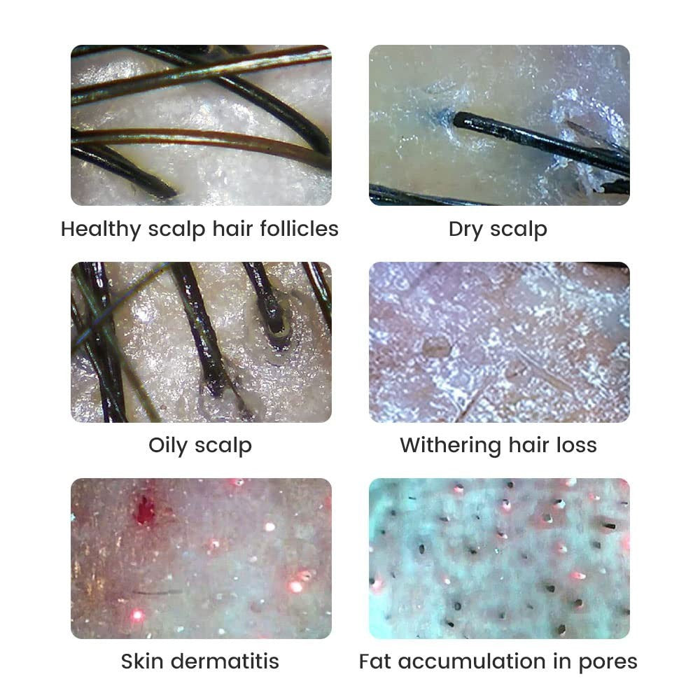 Wireless Skin & Hair Analyzer with Dual Probes & 1080P UV Magnifier