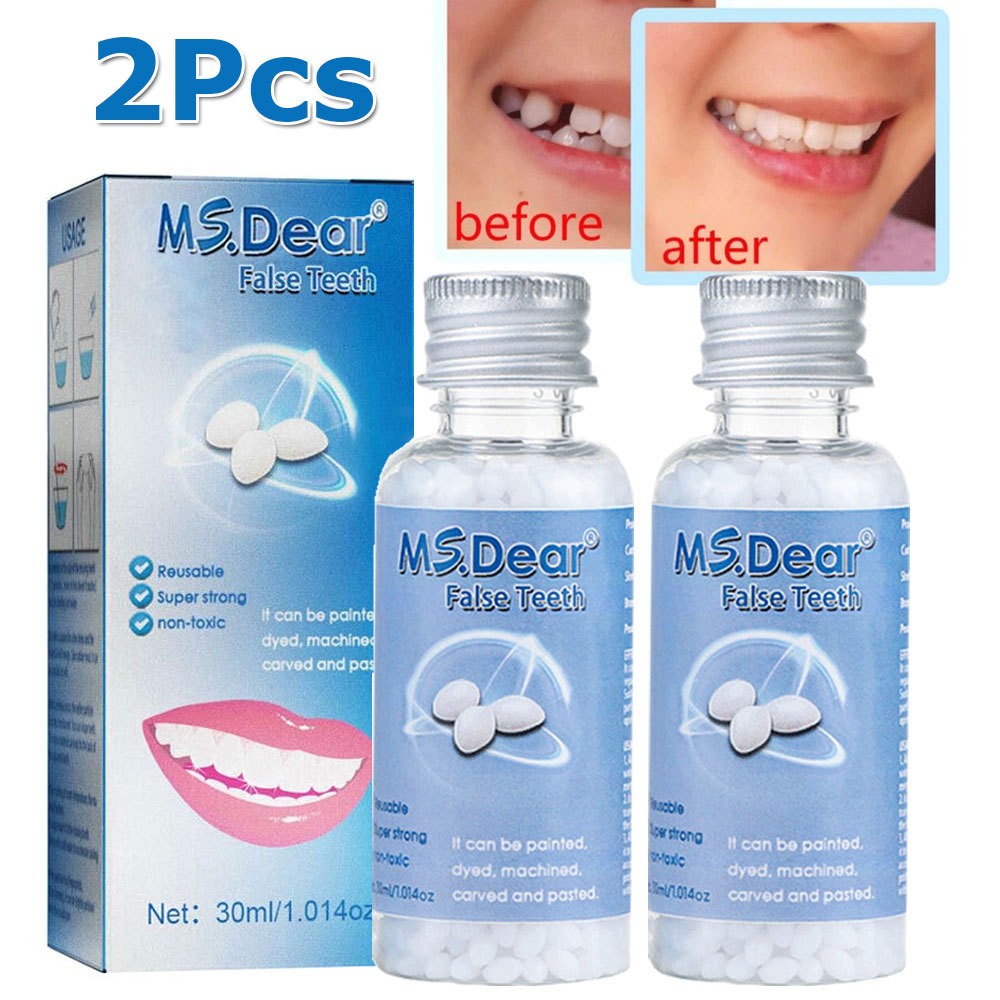 Tooth Repair Kit - Temporary Filling Beads for Broken & Chipped Teeth