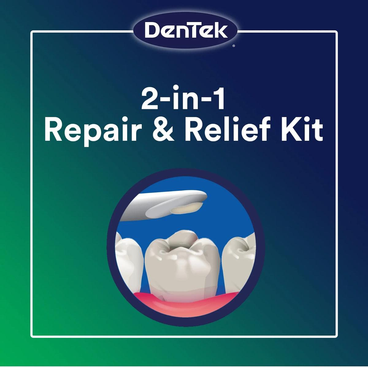 Dental Repair Kit for Loose Fillings - Emergency Temporary Tooth Fix, 13+ Repairs