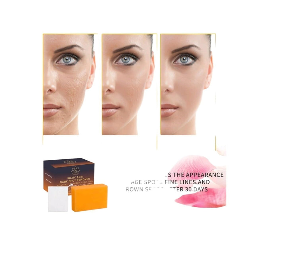 Kojic Acid Dark Spot Remover Soap Bar with Vitamin C Turmeric Collagen 100g