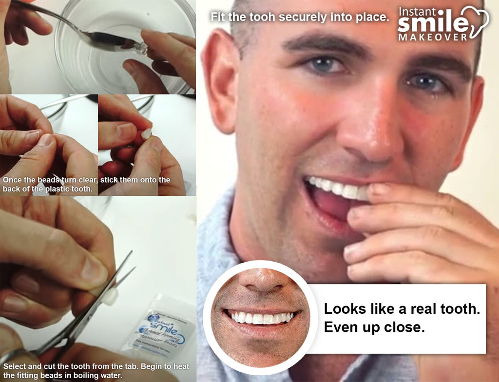 Temporary Tooth Repair Kit - Multi Shade Cosmetic Dental Fix
